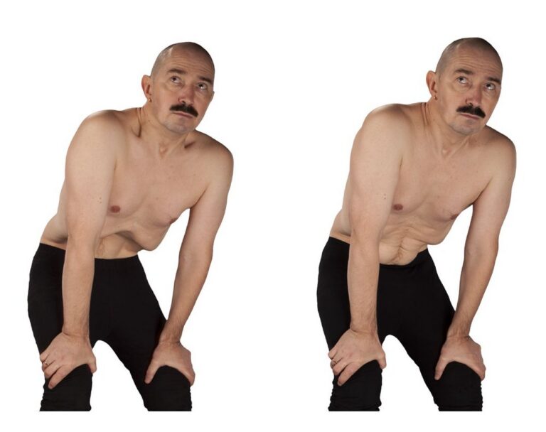 Капалабхати