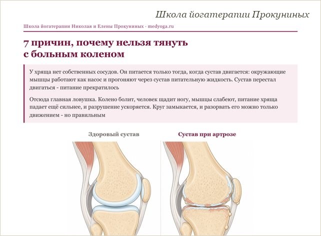 Памятка школы йогатерапии: 7 причин, почему нельзя тянуть с больным коленом