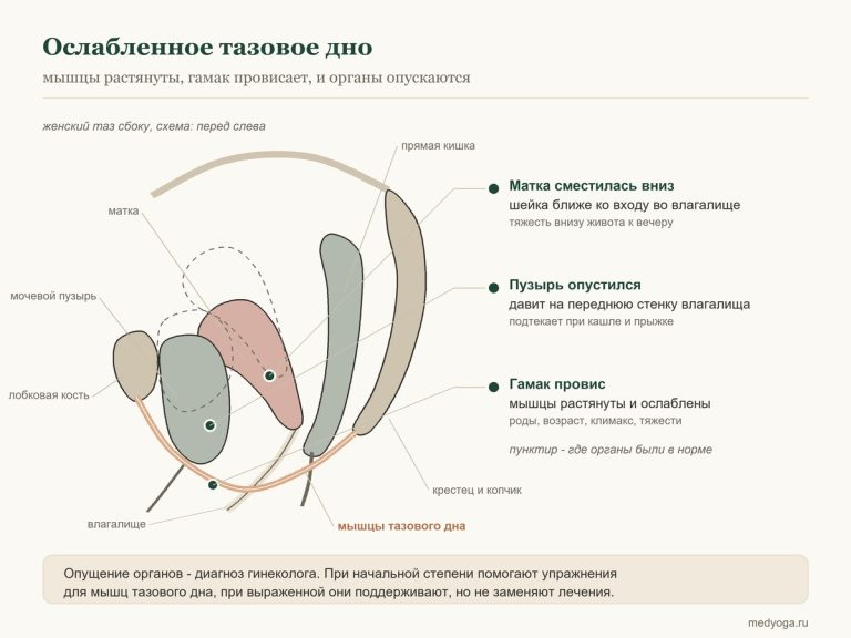 Упражнения при опущении матки: Кегель, мула бандха и что нельзя