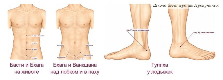 Недержание мочи у женщин