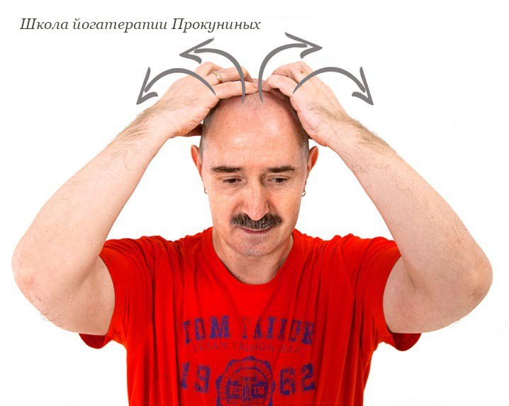 Ранняя седина