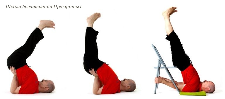 Киста яичника